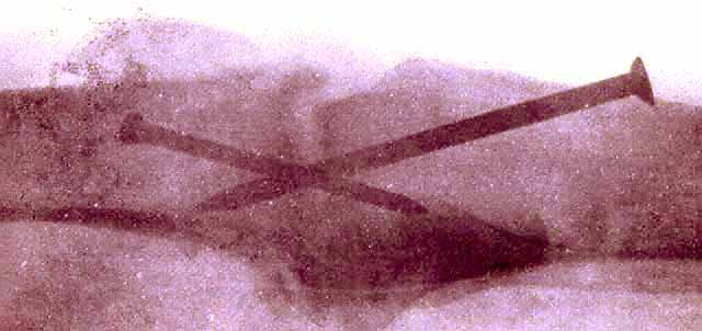 XRAY Sepia.jpg