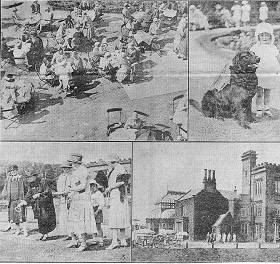 019a Billinge scar   026 ON CT.jpg